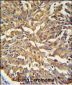 KRT19 Antibody (C-term)
